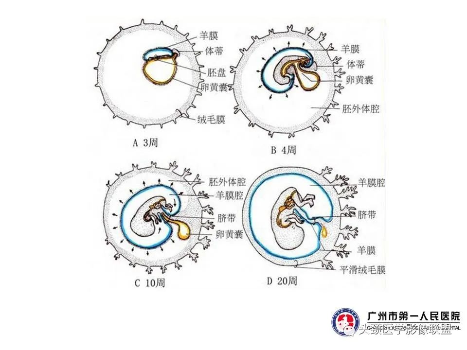 影像PPT - 【PPT】颅内生殖细胞瘤影像诊断及鉴别-4