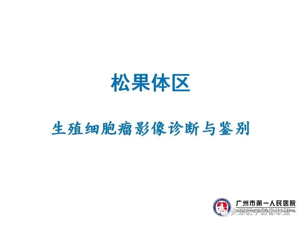 影像PPT - 【PPT】颅内生殖细胞瘤影像诊断及鉴别-8