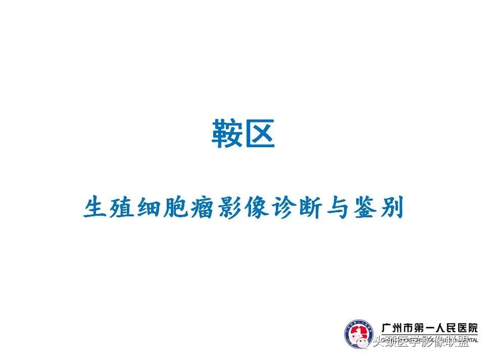 影像PPT - 【PPT】颅内生殖细胞瘤影像诊断及鉴别-26