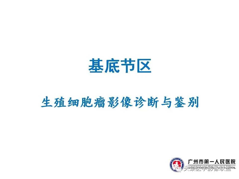 影像PPT - 【PPT】颅内生殖细胞瘤影像诊断及鉴别-39
