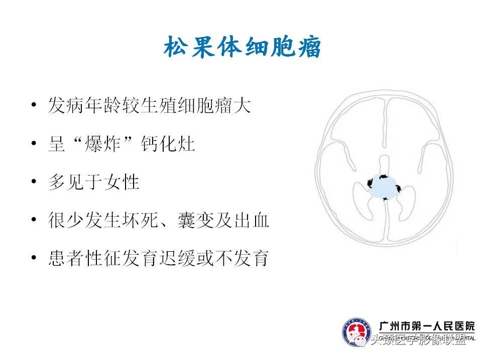 影像PPT - 【PPT】颅内生殖细胞瘤影像诊断及鉴别-1