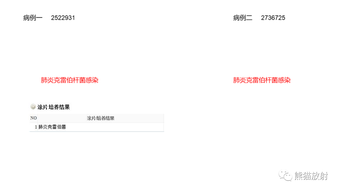 影像PPT - 【病例】肺炎克雷伯杆菌感染2例CT影像-22