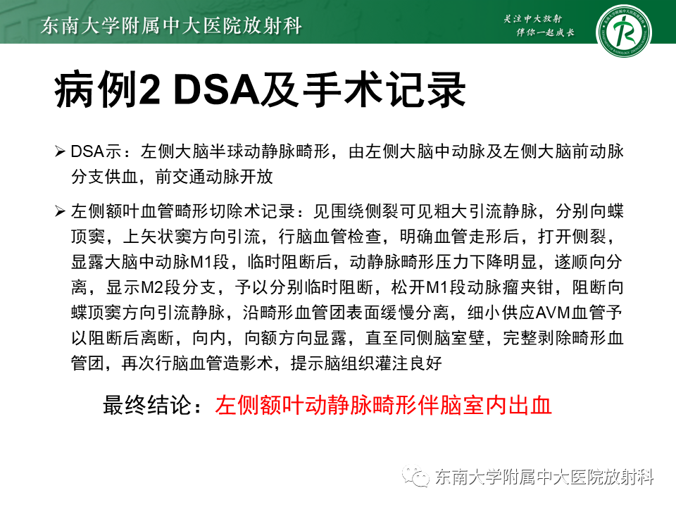影像PPT - 【病例】脑血管畸形伴出血4例CT及MR影像-13 影像PPT - 【病例】脑血管畸形伴出血4例CT及MR影像-13