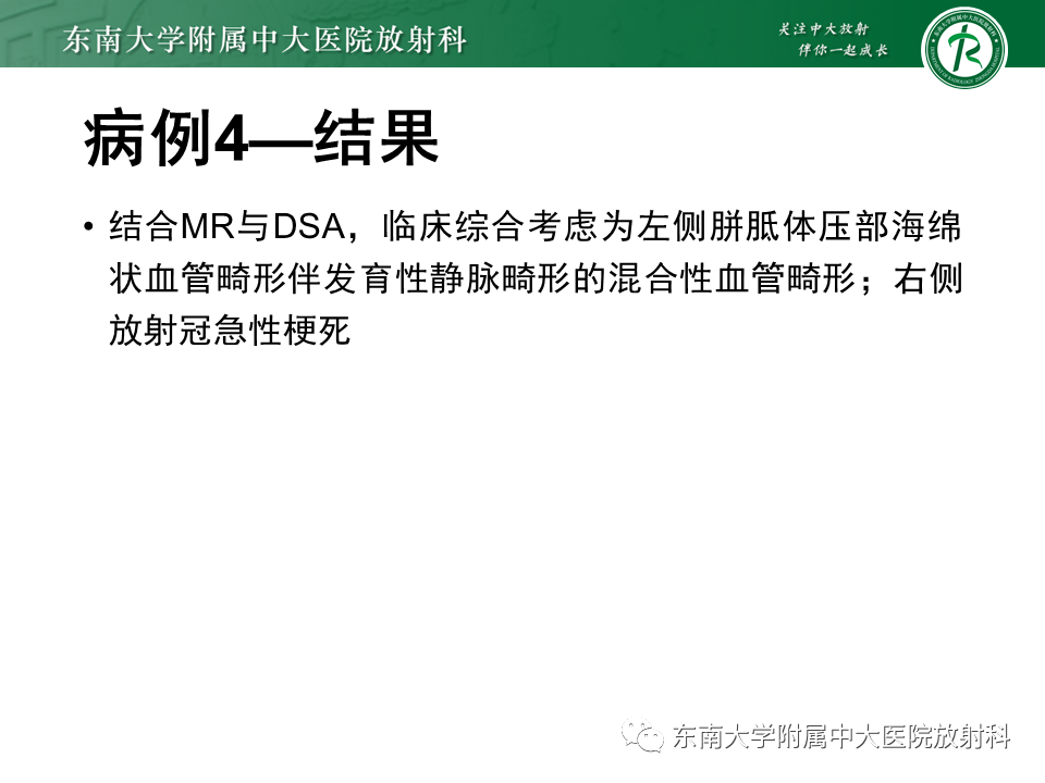 影像PPT - 【病例】脑血管畸形伴出血4例CT及MR影像-15 影像PPT - 【病例】脑血管畸形伴出血4例CT及MR影像-15