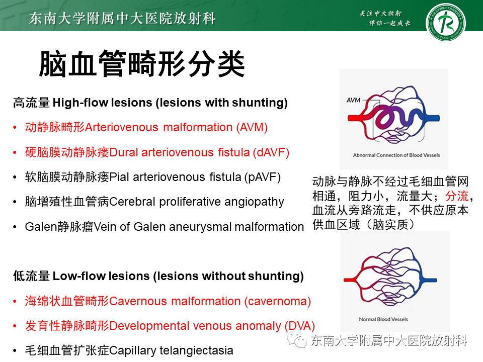 影像PPT - 【病例】脑血管畸形伴出血4例CT及MR影像-19 影像PPT - 【病例】脑血管畸形伴出血4例CT及MR影像-19