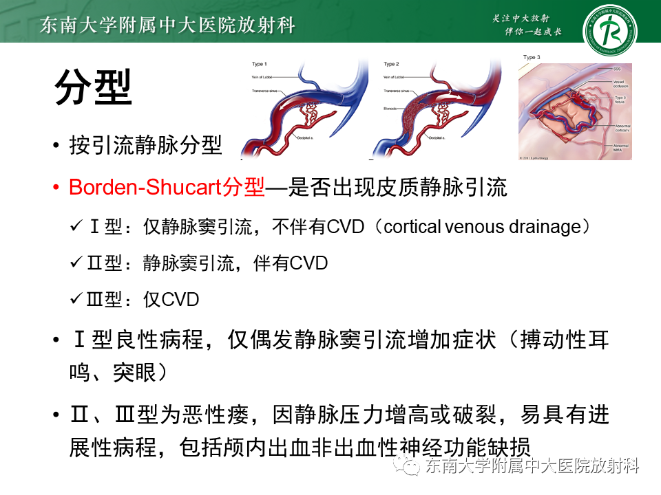 影像PPT - 【病例】脑血管畸形伴出血4例CT及MR影像-27 影像PPT - 【病例】脑血管畸形伴出血4例CT及MR影像-27