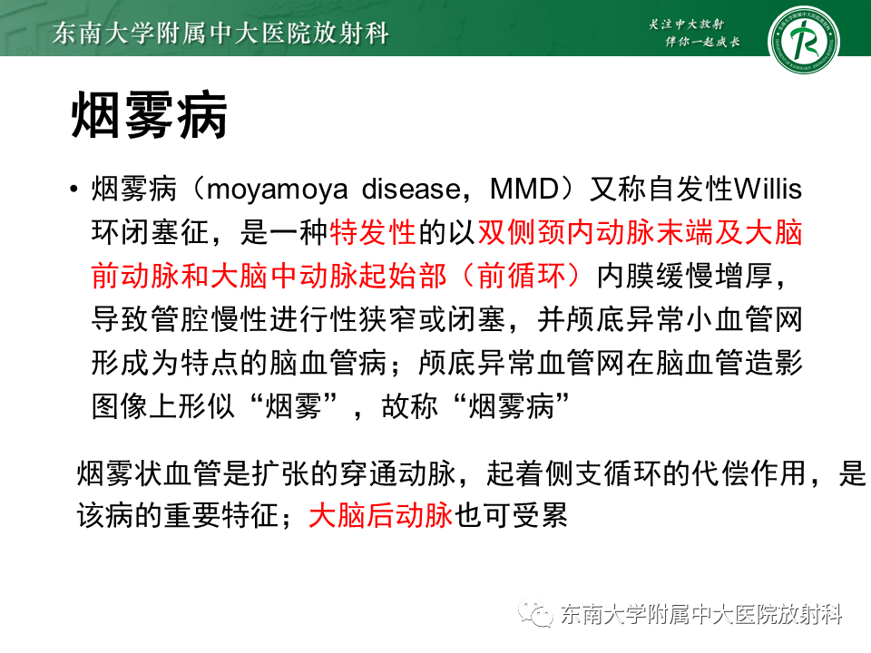 影像PPT - 【病例】脑血管畸形伴出血4例CT及MR影像-30 影像PPT - 【病例】脑血管畸形伴出血4例CT及MR影像-30