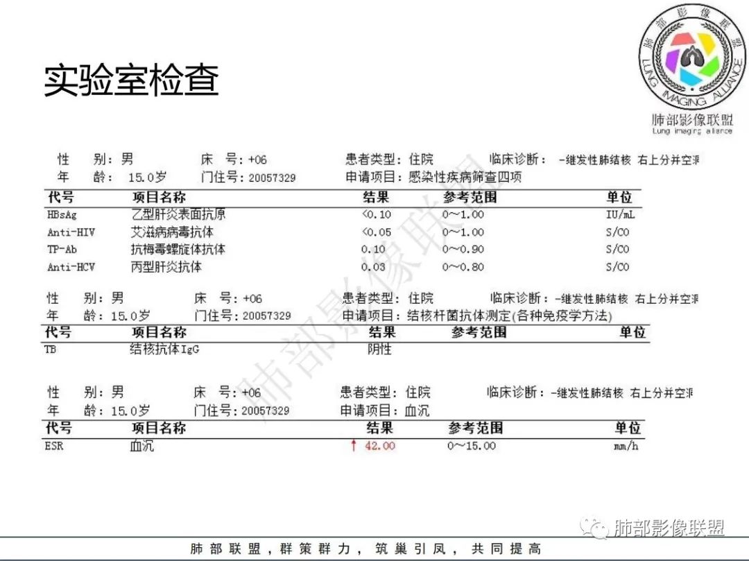 影像PPT - 【病例】 青少年肺隐球菌病1例CT影像-5