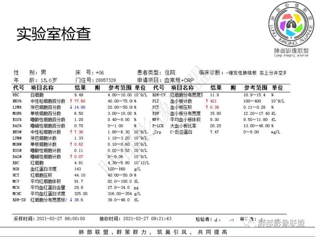 影像PPT - 【病例】 青少年肺隐球菌病1例CT影像-4