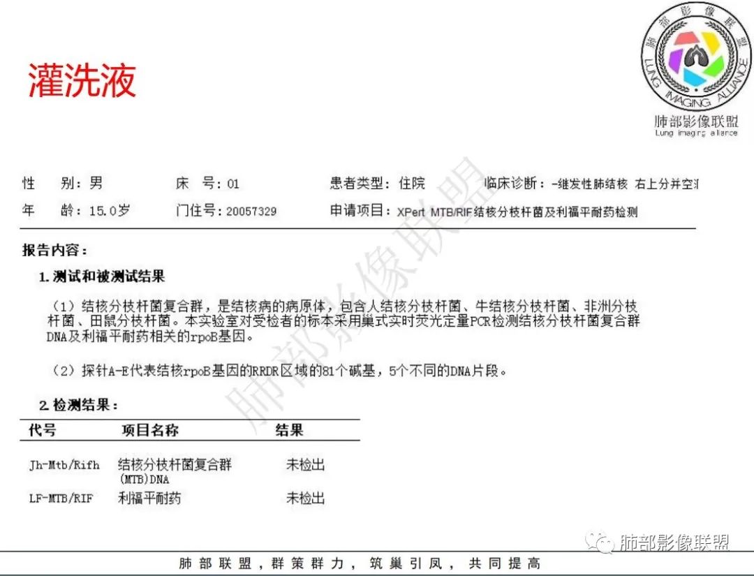 影像PPT - 【病例】 青少年肺隐球菌病1例CT影像-9