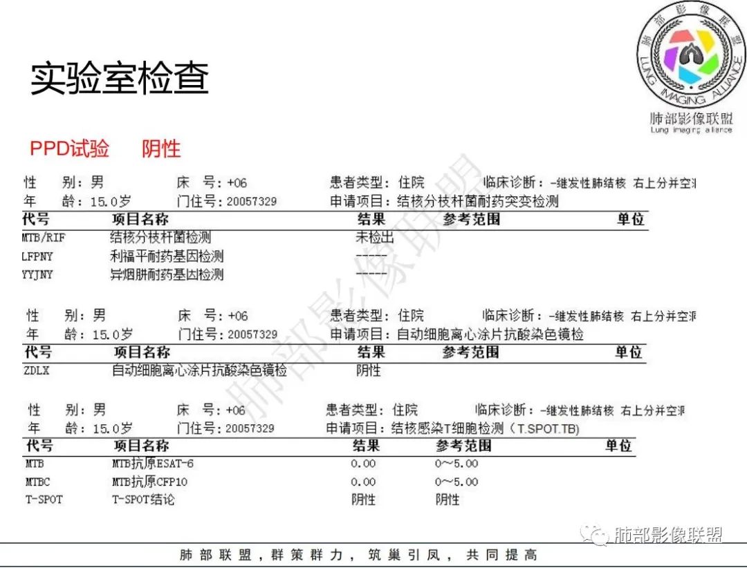 影像PPT - 【病例】 青少年肺隐球菌病1例CT影像-8