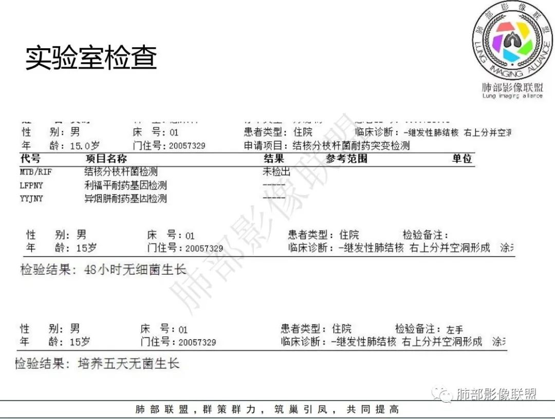 影像PPT - 【病例】 青少年肺隐球菌病1例CT影像-10