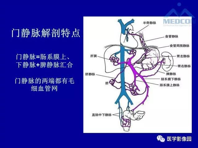 影像PPT - 【PPT】门脉高压分型及影像学特征-2