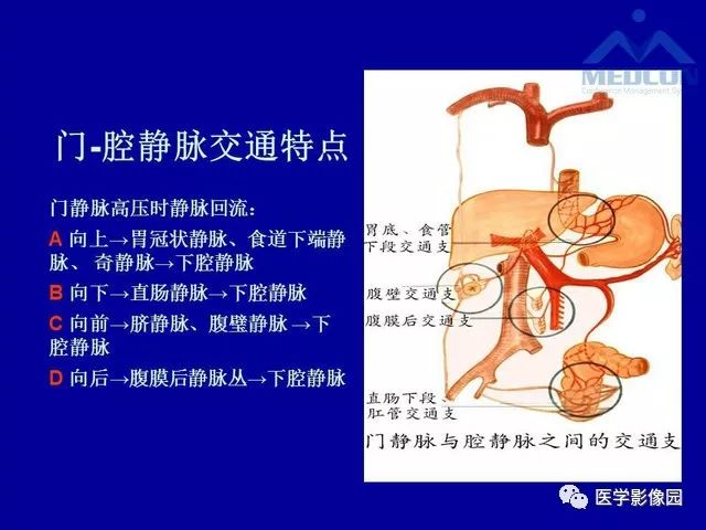 影像PPT - 【PPT】门脉高压分型及影像学特征-3