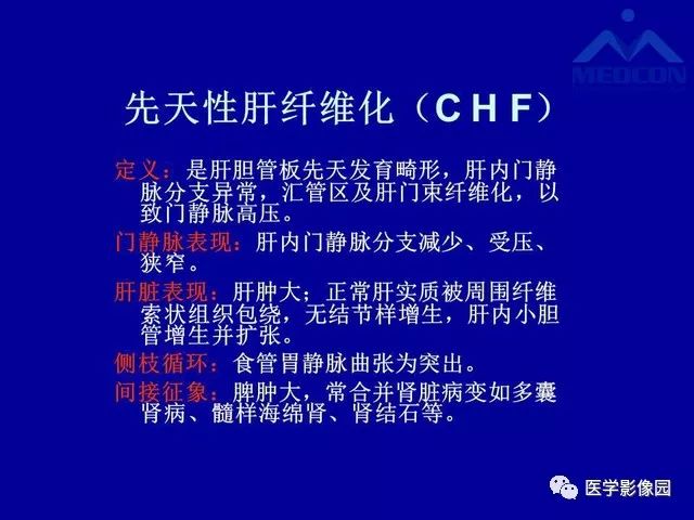 影像PPT - 【PPT】门脉高压分型及影像学特征-27