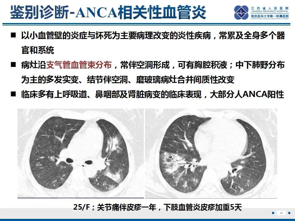 影像PPT - 【PPT】胺碘酮相关性肺损伤-34