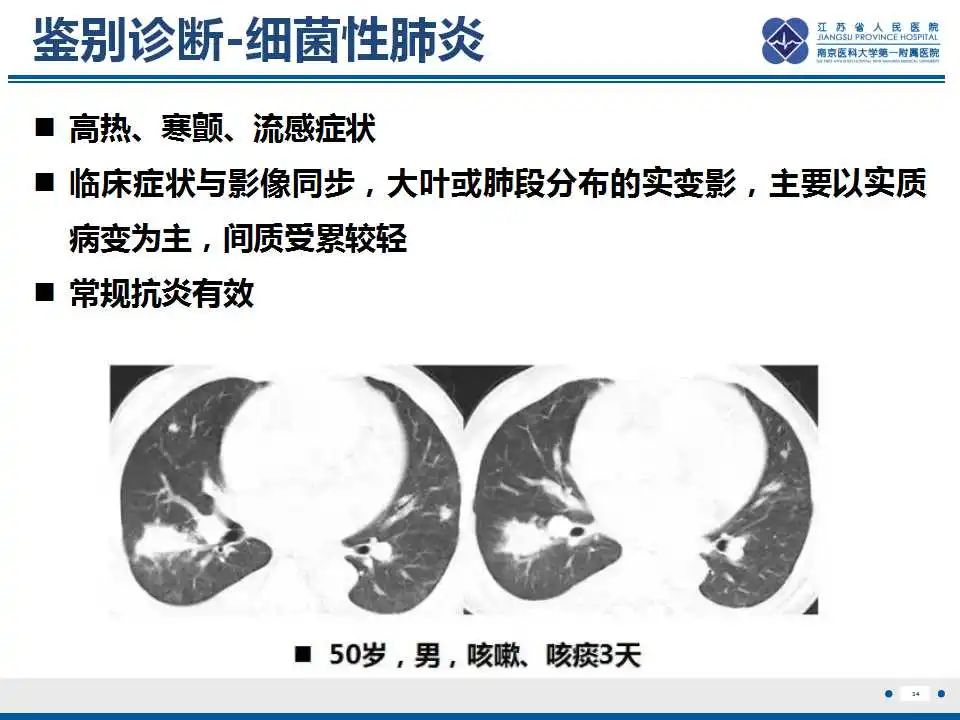 影像PPT - 【PPT】胺碘酮相关性肺损伤-35