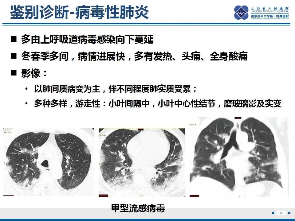影像PPT - 【PPT】胺碘酮相关性肺损伤-36