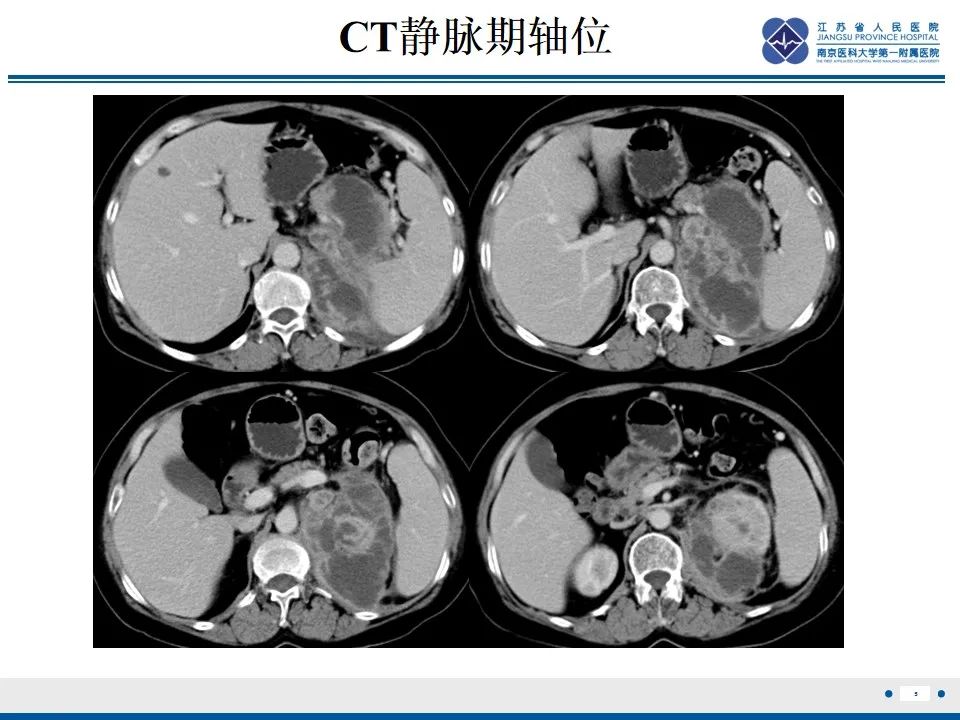 影像PPT - 【PPT】软斑病-6