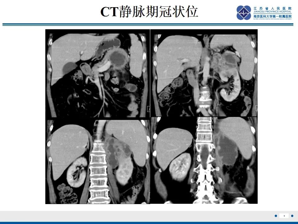 影像PPT - 【PPT】软斑病-7