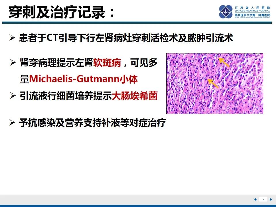影像PPT - 【PPT】软斑病-17