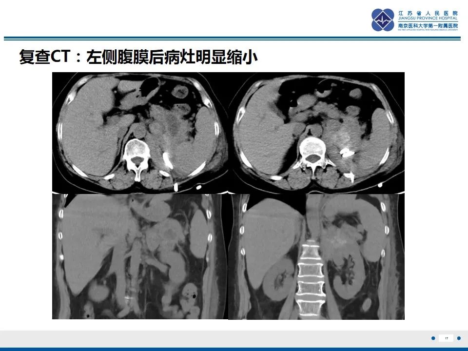 影像PPT - 【PPT】软斑病-18