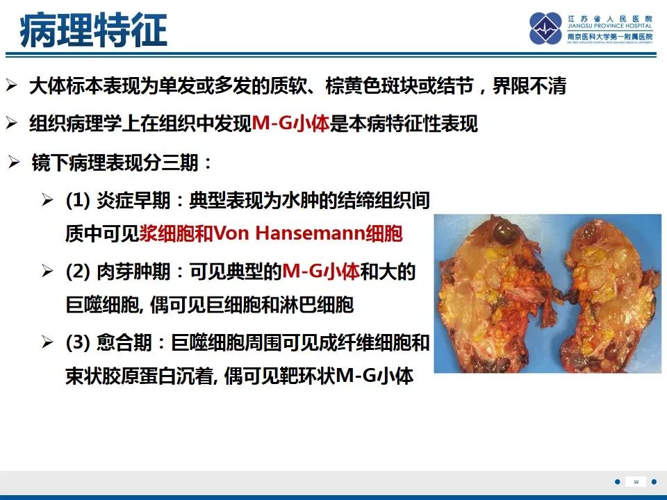 影像PPT - 【PPT】软斑病-23