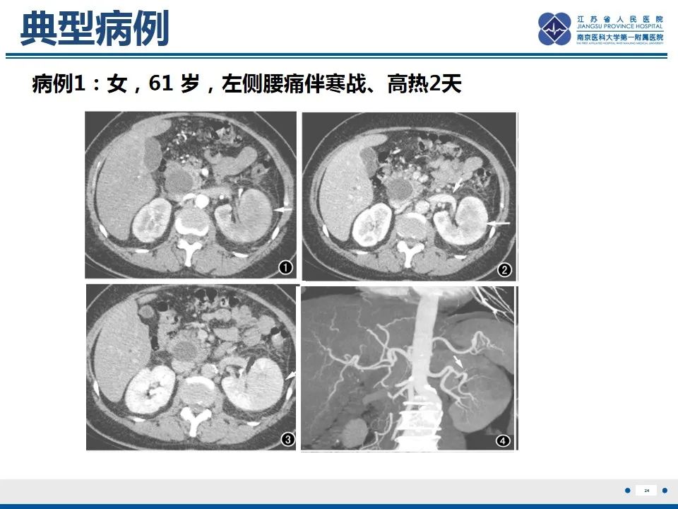 影像PPT - 【PPT】软斑病-25