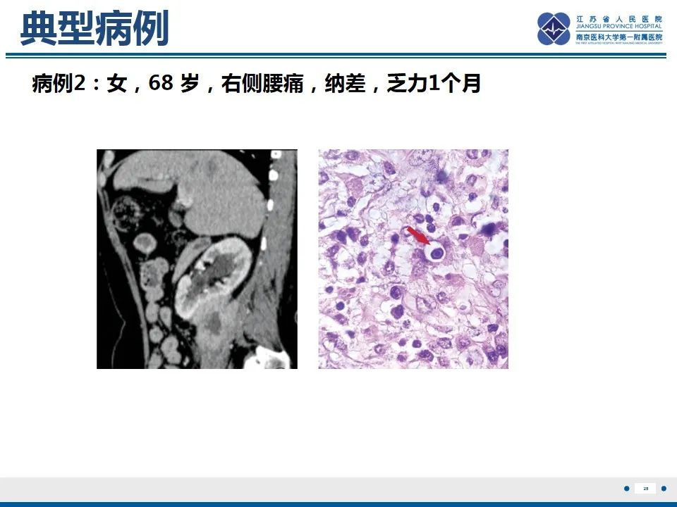 影像PPT - 【PPT】软斑病-26