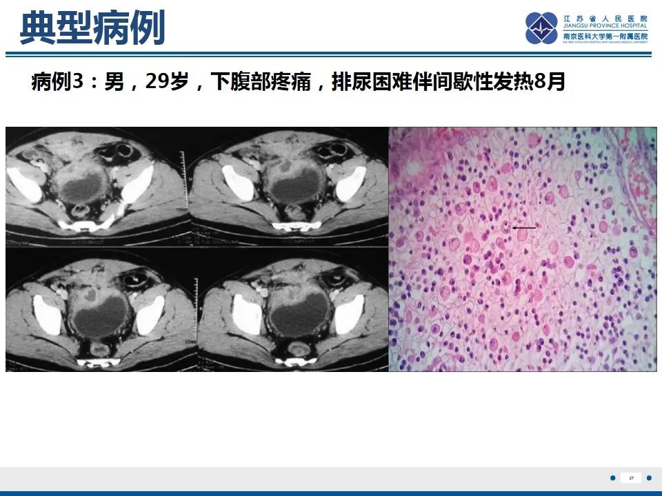 影像PPT - 【PPT】软斑病-28