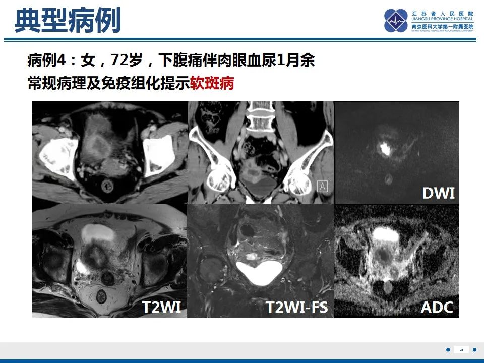 影像PPT - 【PPT】软斑病-29