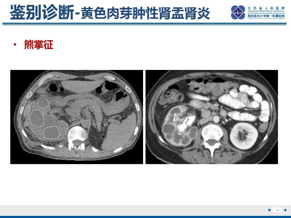 影像PPT - 【PPT】软斑病-34