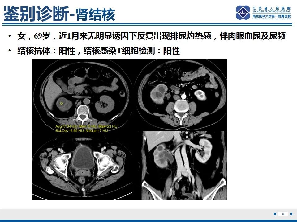 影像PPT - 【PPT】软斑病-36