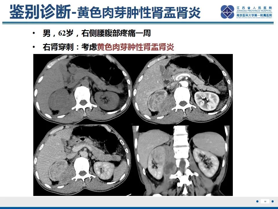 影像PPT - 【PPT】软斑病-33