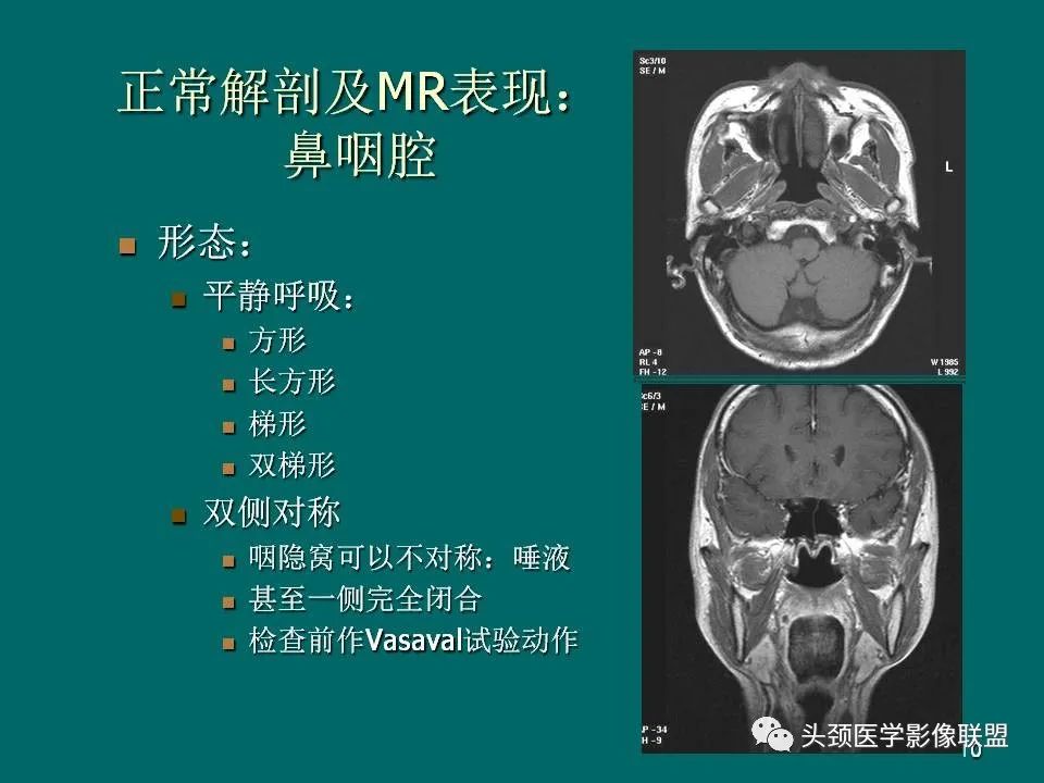 影像PPT - 【PPT】鼻咽癌的MRI诊断-10