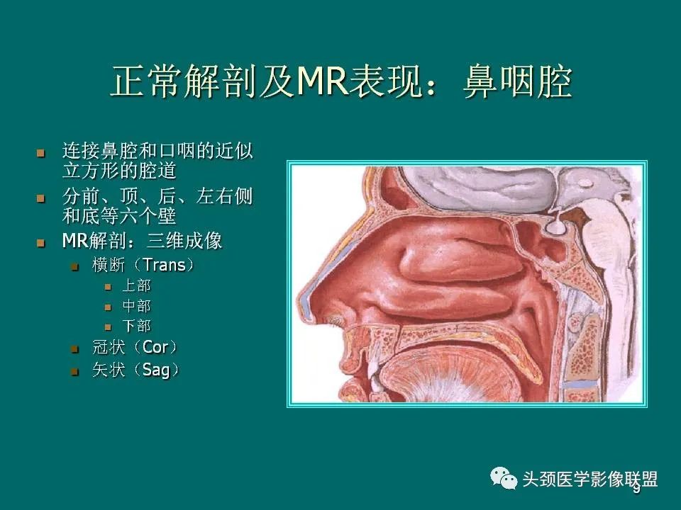 影像PPT - 【PPT】鼻咽癌的MRI诊断-9