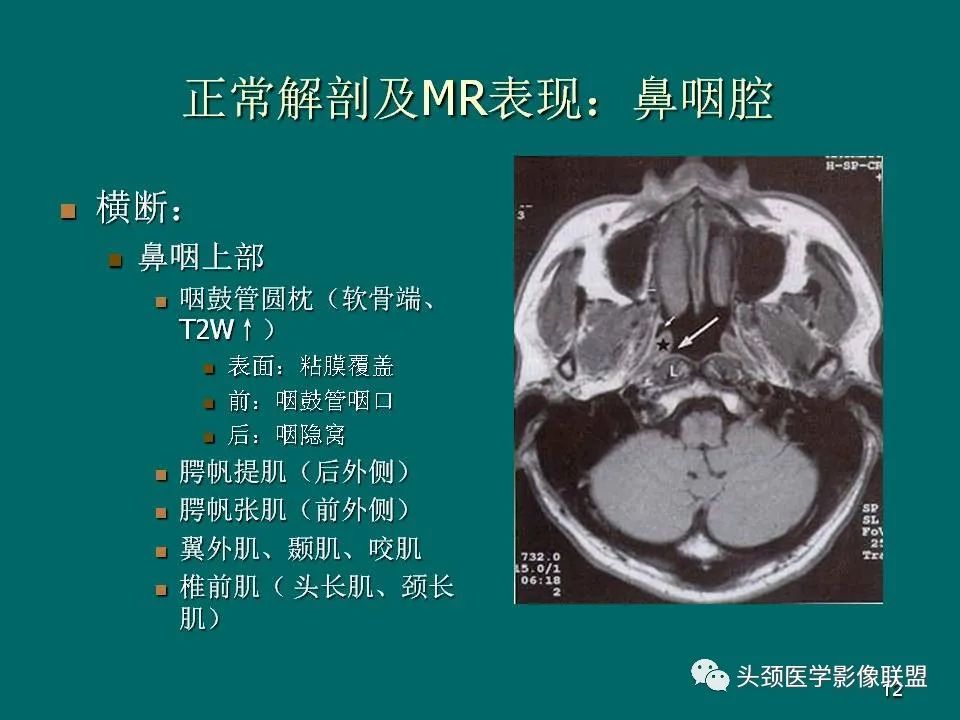 影像PPT - 【PPT】鼻咽癌的MRI诊断-12