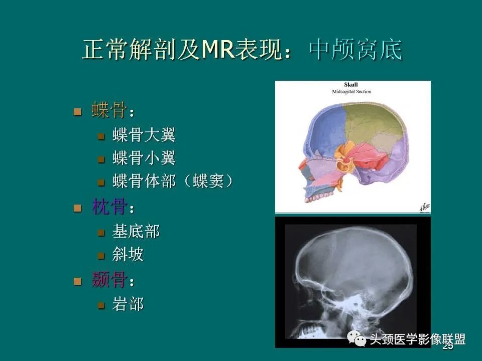 影像PPT - 【PPT】鼻咽癌的MRI诊断-25