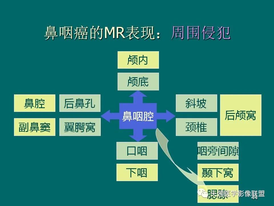 影像PPT - 【PPT】鼻咽癌的MRI诊断-44