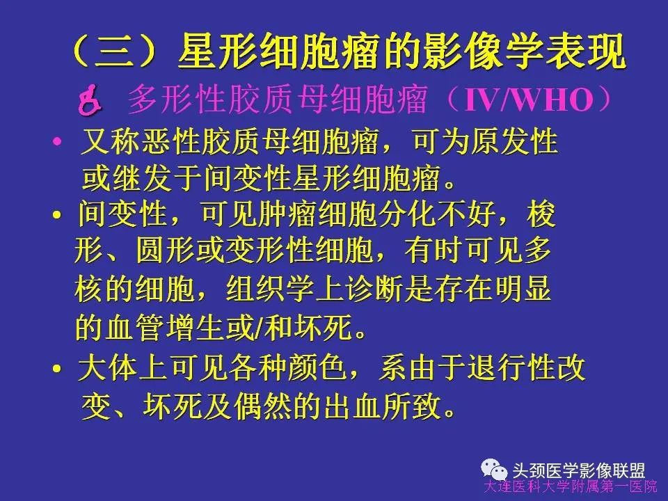 影像PPT - 【PPT】胶质瘤影像诊断及鉴别诊断-47