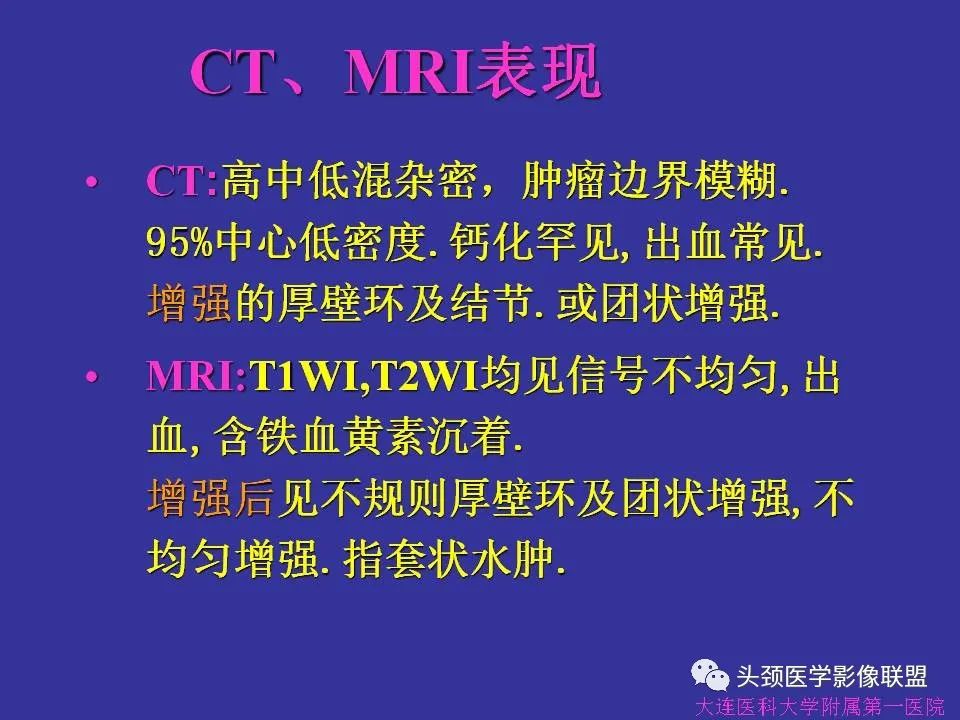 影像PPT - 【PPT】胶质瘤影像诊断及鉴别诊断-48
