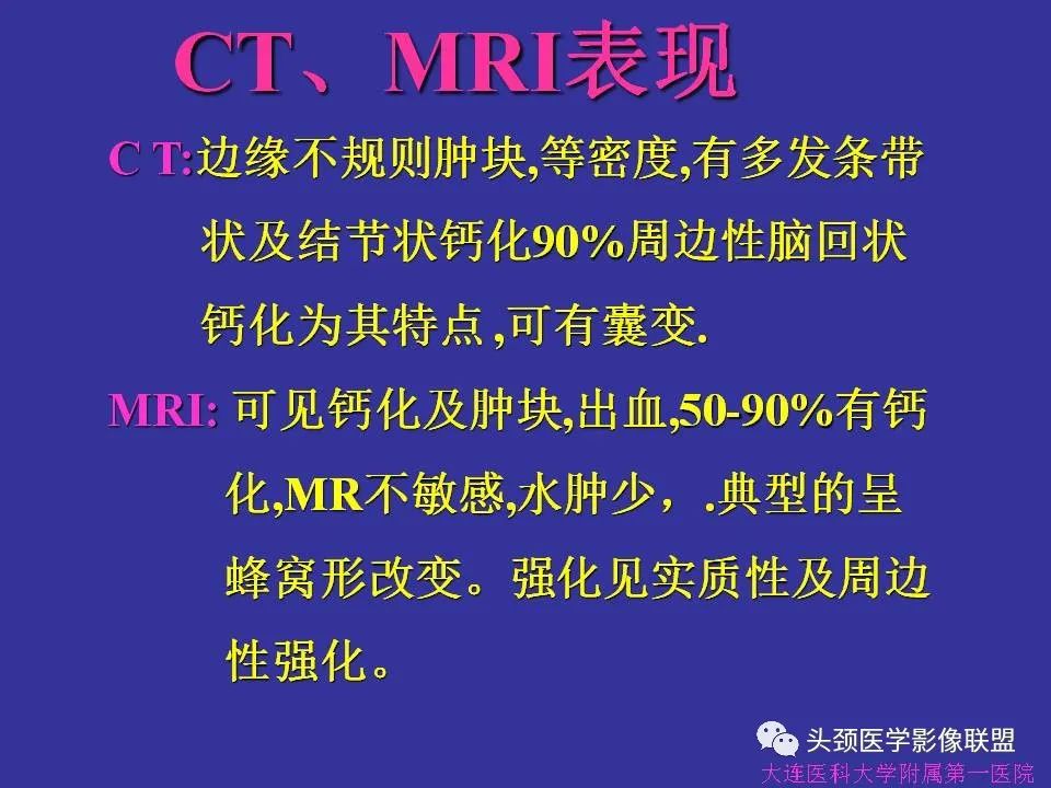 影像PPT - 【PPT】胶质瘤影像诊断及鉴别诊断-66