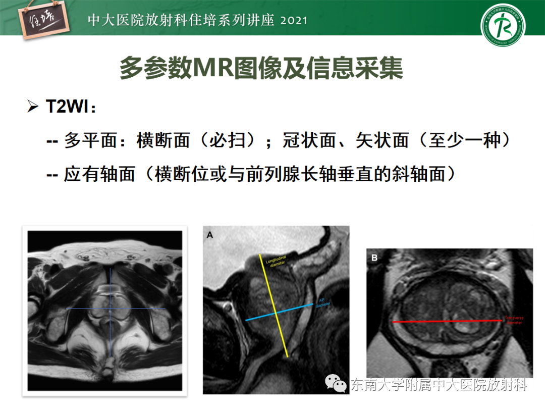影像PPT - 【PPT】前列腺PI-RADS v2.1要点解读及临床应用-8