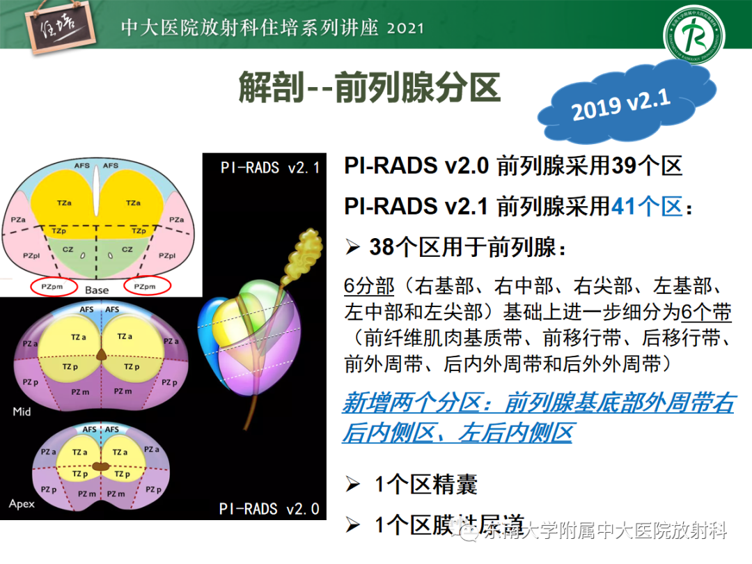 影像PPT - 【PPT】前列腺PI-RADS v2.1要点解读及临床应用-10