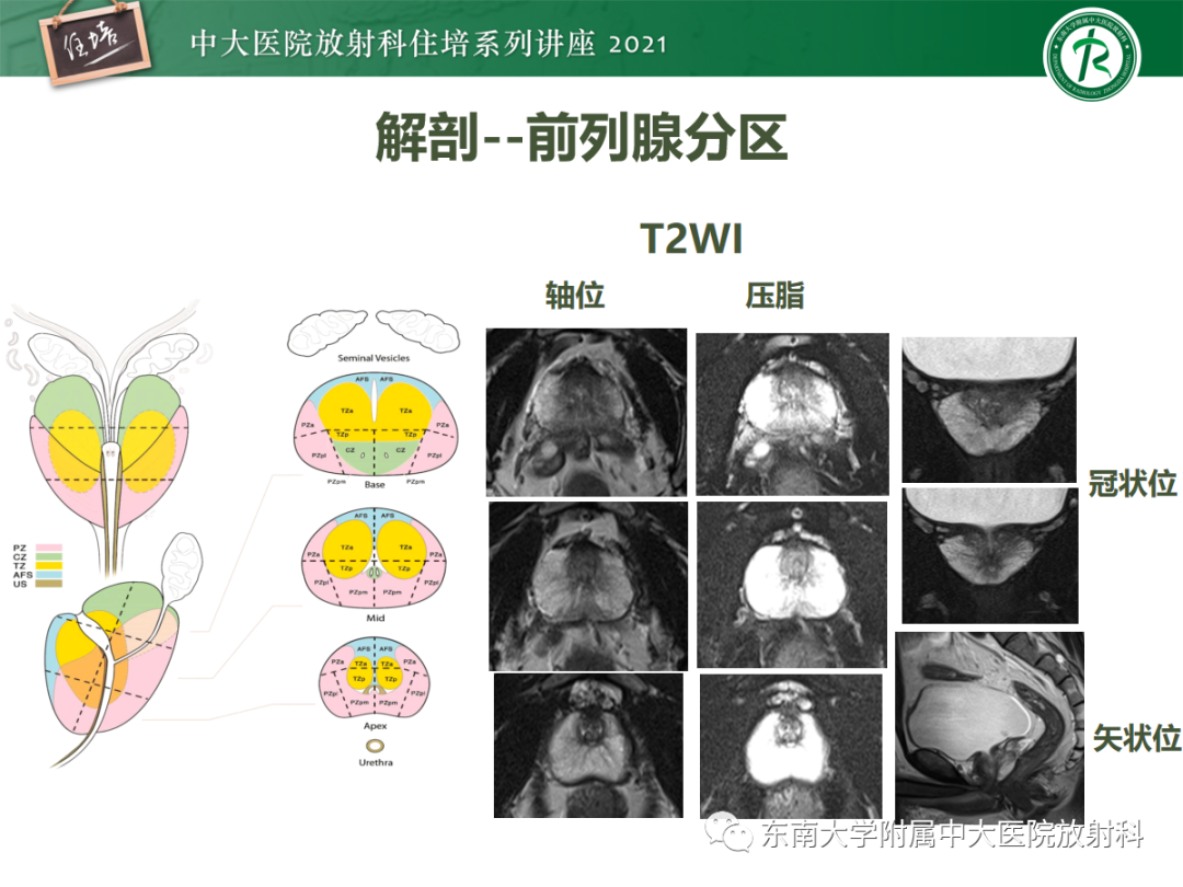 影像PPT - 【PPT】前列腺PI-RADS v2.1要点解读及临床应用-11