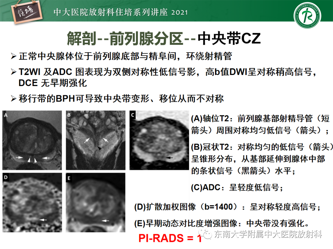 影像PPT - 【PPT】前列腺PI-RADS v2.1要点解读及临床应用-12