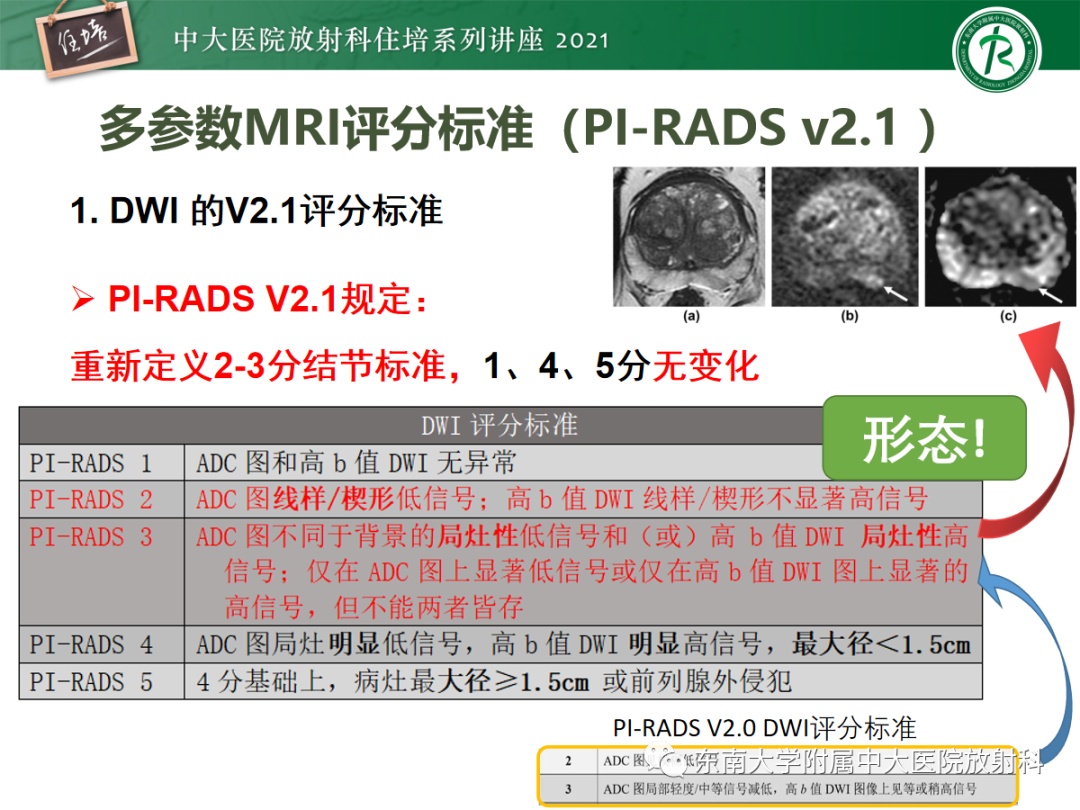 影像PPT - 【PPT】前列腺PI-RADS v2.1要点解读及临床应用-18