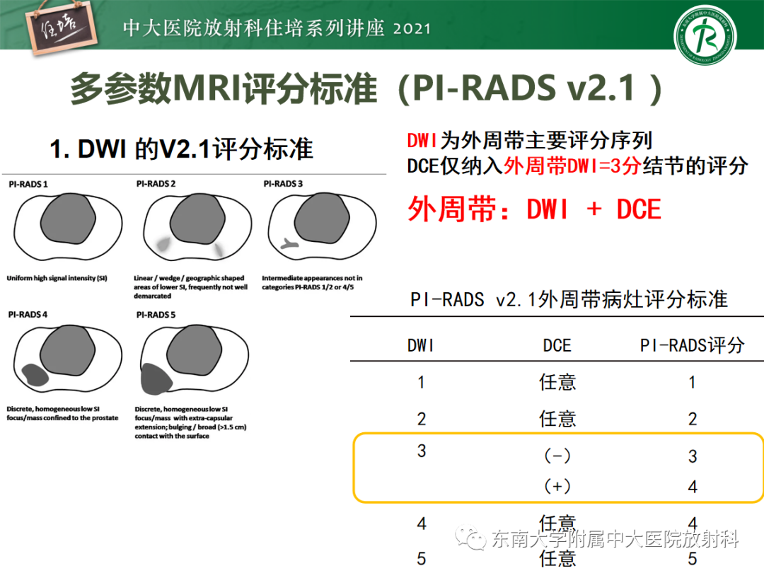 影像PPT - 【PPT】前列腺PI-RADS v2.1要点解读及临床应用-19