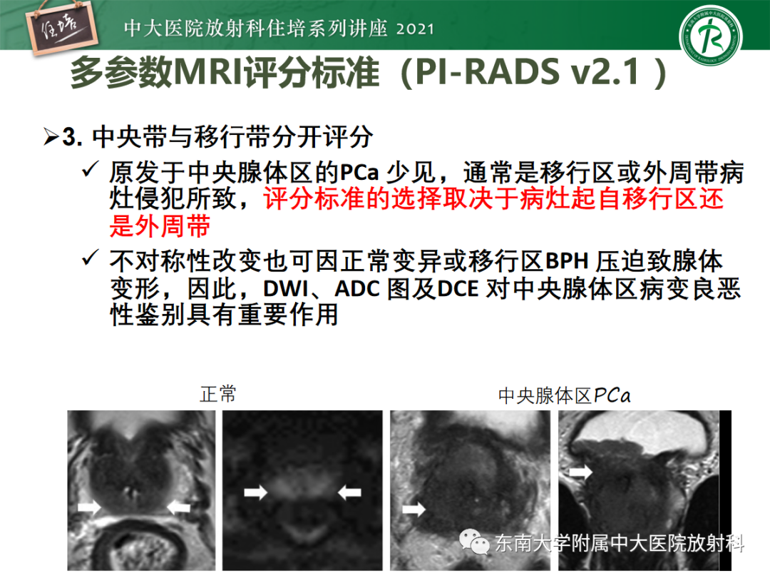 影像PPT - 【PPT】前列腺PI-RADS v2.1要点解读及临床应用-21