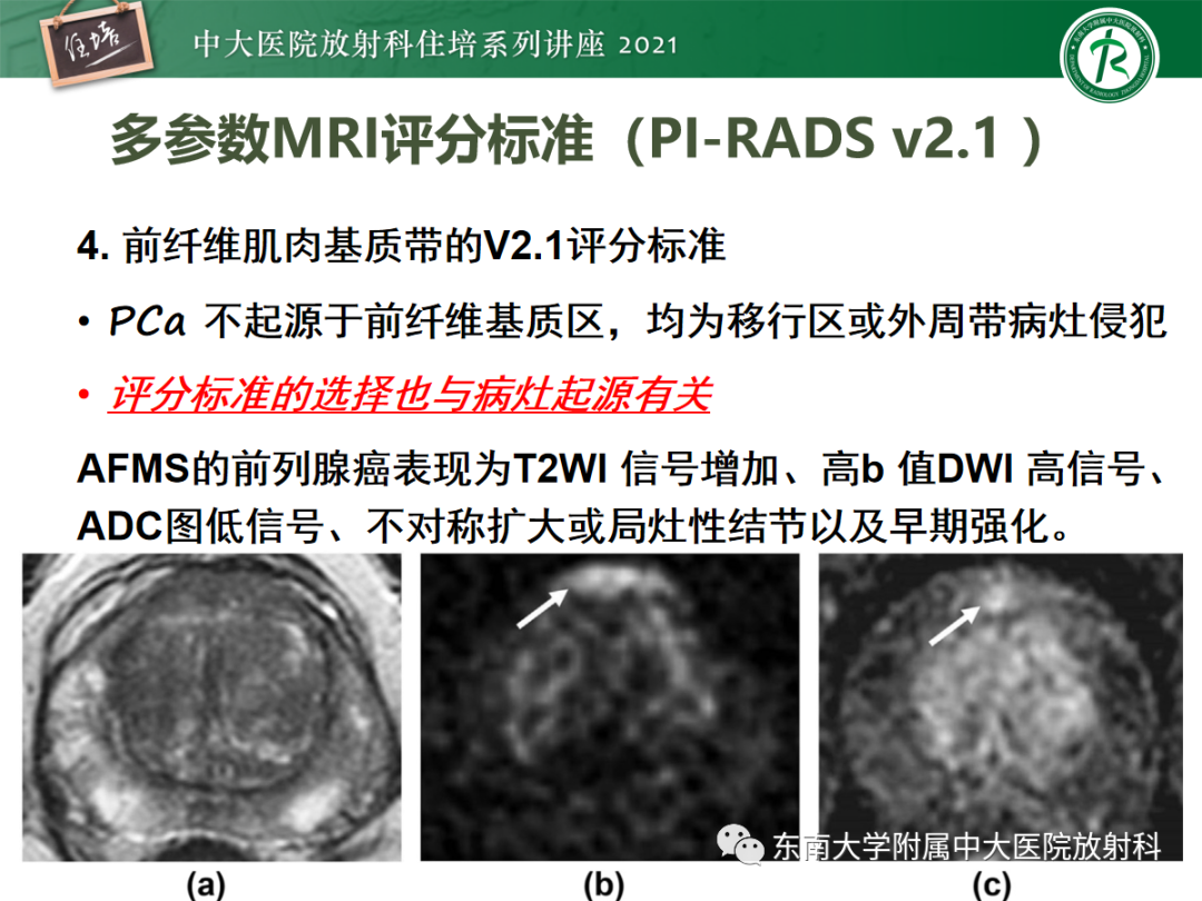 影像PPT - 【PPT】前列腺PI-RADS v2.1要点解读及临床应用-24